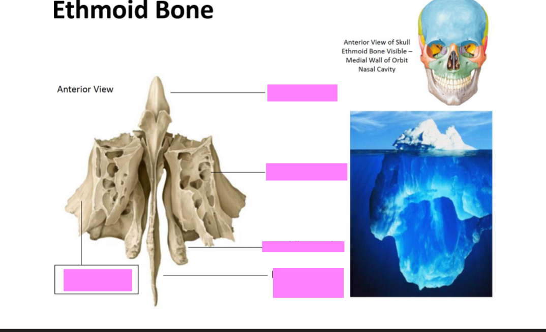<p>Label the Ethmoid bone</p>