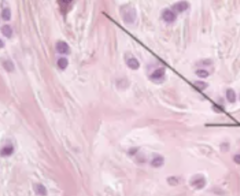 <p>structure; tissue type</p>