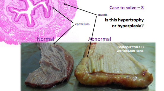 <p>is it hypertrophy or hyperplasia</p>