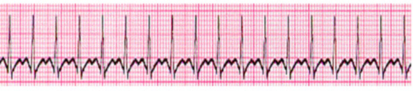 <p>what is the HR of this</p>