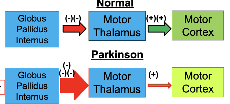 <p>Parkinson’s Disease</p>