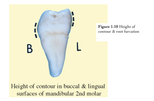 <p>The greatest area of contour on the facial, lingual, and proximal surfaces critical to periodontal health.</p>