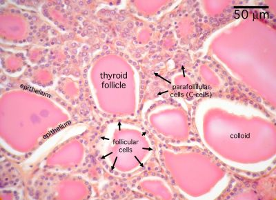 <p>Follicles filled with colloid; follicular cells surround colloid; parafollicular cells between follicles.</p>
