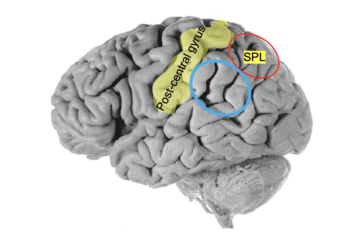 <p>Inferior parietal lobe</p>