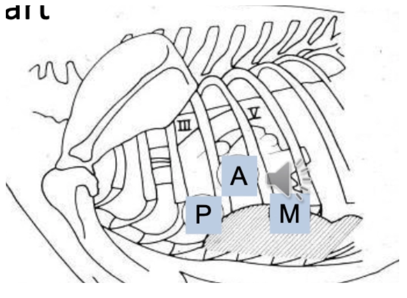 <p><u>Location:</u> Left side, 5th ICS = Mitral valve at the level of the costochondral junction</p><p><u>DDx:</u></p><ul><li><p><strong>Caudal Displacement</strong></p><ol><li><p>Enlarged L-heart</p></li><li><p>Space-occupying mass</p></li></ol></li><li><p><strong>Right Displacement</strong></p><ol><li><p>RVE</p></li><li><p>Space-occupying mass</p></li></ol></li><li><p><strong>Hyperkinetic</strong> = Volume overload</p></li><li><p><strong>Hypokinetic</strong></p><ol><li><p>Obesity</p></li><li><p>Reduced contractility</p></li><li><p>Pleural/pericardial effusion</p></li><li><p>Mass</p></li></ol></li></ul><p></p>