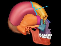 <p>What type of suture is shown?</p>