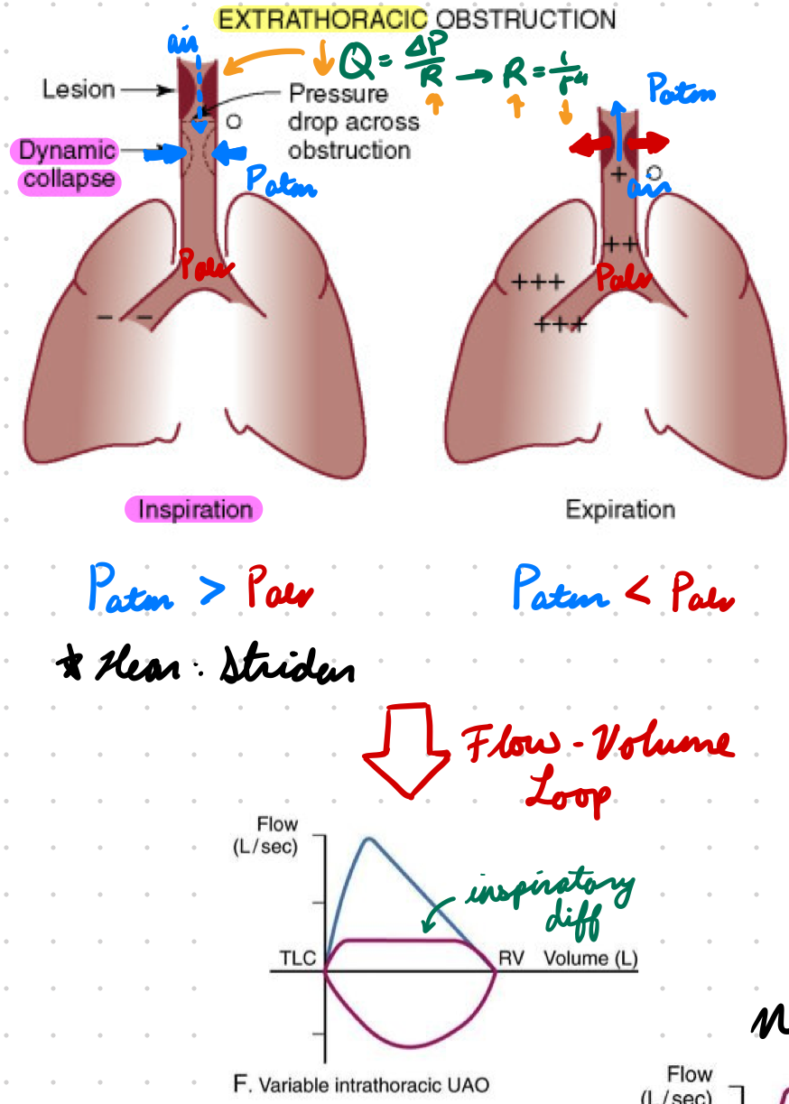 <p>Alveolar P > Atmospheric P = Pressure opens airway</p>