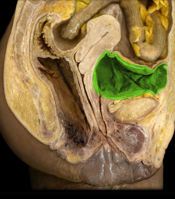 <p>sorry bad picture but there’s no other views</p>