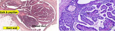 <p>What pathology? </p>