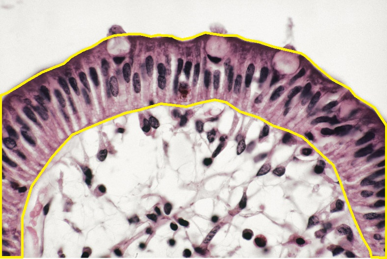 term image