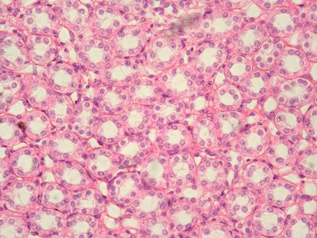 <p>-Function: Absorbs water, ions, nutrients and secretes hormones/enzymes; helps transport materials through ducts and tubules</p><p>-Found: Kidney tubules, glands, ovaries</p><p>-Description: One layer of cube-shaped cells with round nuclei</p>