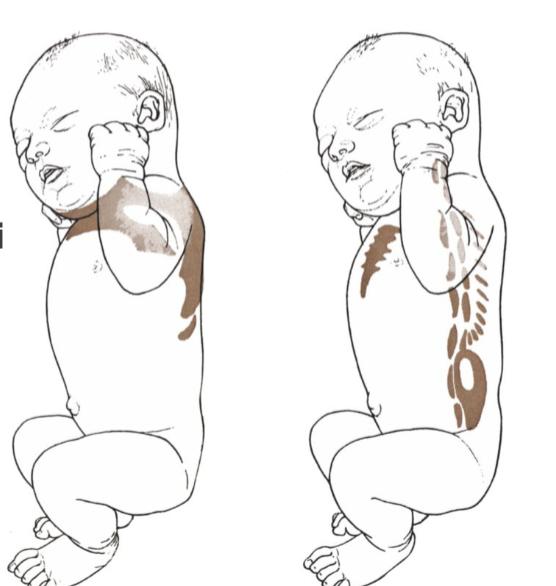 <p>What occurs to prepare for birth in weeks 17-20</p>