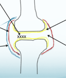 <p>what are the xx’s in this image</p>