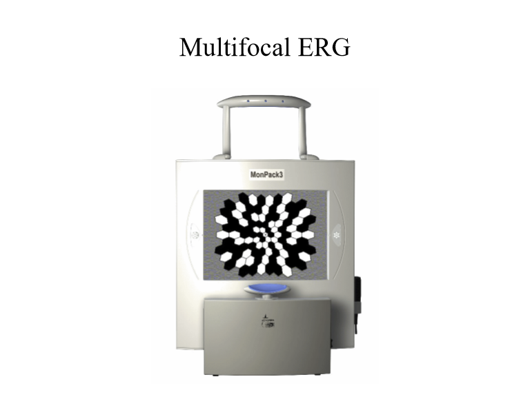 <p>A focal ERG uses a small, localized flash (e.g., confined to the macula).<br>→ Designed to detect regional dysfunction, especially macular disease, which may be missed on full‑field ERG.</p>