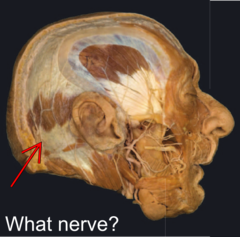 <p>Identify the structure</p>
