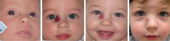 <ul><li><p>not always present at birth</p></li><li><p>rapid increase in size</p></li><li><p>involution</p></li></ul><p></p>