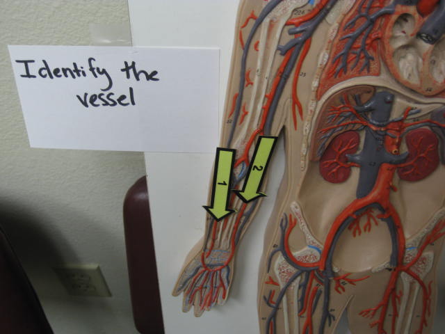 <p>Identify The Vessel 1 and 2?</p><p>Lab Image 3-8</p>