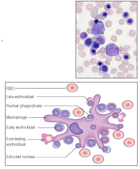 <p>- Large early cells (erythroblast)</p><p>- Cells get smaller as they mature</p><p>- Nucleus: chromatin condensation</p><p>- Haemoglobin in cytoplasm</p><p>- Nucleus extruded</p><p>.</p><p>- Islands near macrophages</p><p>- Mature red blood cells: Erythrocyte, Anuclear biconcave disc, flexible cell membrane</p>