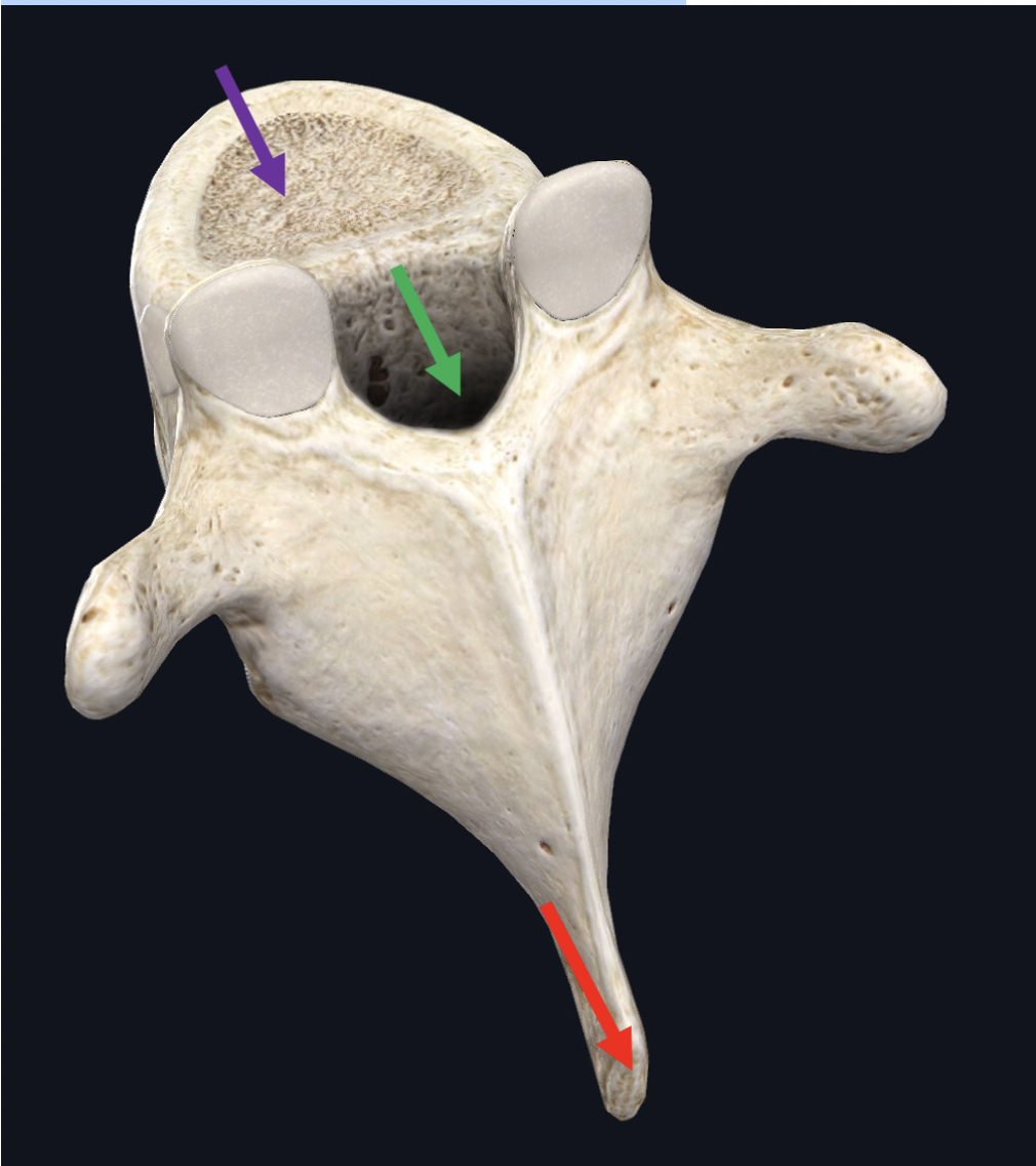 <p><span>Identify the structure at the tip of the red arrow</span></p>