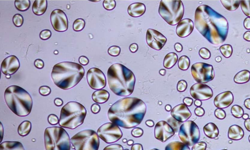 <p>Identify the following starch granules</p>