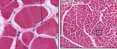 <p>Identify the connective tissue cell?</p>