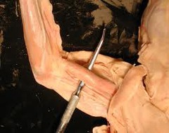 <p>muscle that serves to stabilize the shoulder joint and flex the elbow</p>