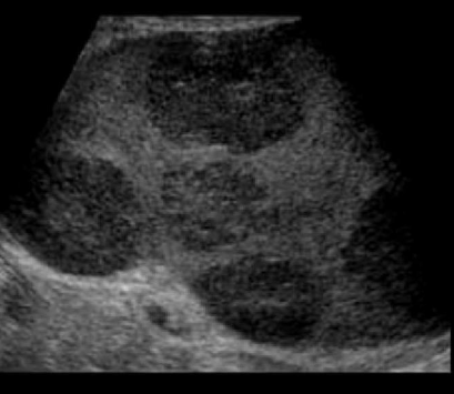 <p>Identify this image. </p>