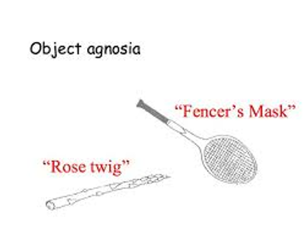 <p>Inability to identify objects</p>