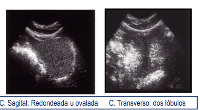 <p>Prostata4</p>