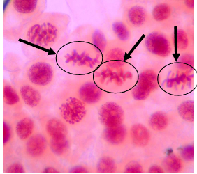 <p><span>All the chromatids are aligned in a single plane in center of the cell<br>• Chromosome “tails” point outwards</span></p>