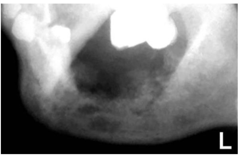 <p>CHẨN ĐOÁN?</p>