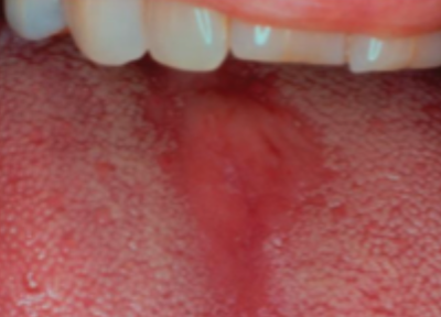 <p>what is this condition</p>