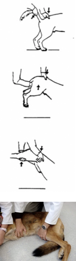 <p><u>Definition:</u> Presentation of lumbosacral disease with MULTIPLE different causes → Compression of spinal nerve roots (NOT spinal cord) of the cauda equina</p><ul><li><p>eg. empyema due to grass seed</p></li></ul><p><u>Clinical Signs:</u></p><ol><li><p>Lumbosacral pain</p><ol><li><p><strong>Tail Jack</strong> (<u>-ve:</u> Many normal dogs do not tolerate → False positives)</p></li><li><p><strong>Pelvic Tilt</strong> = Cradle pelvis with one hand and place other hand over back to act as fulcrum → Extension of back and NOT back legs (<u>+ve:</u> Best test with highest DSp)</p></li><li><p><strong>Lordosis Test</strong> = Concurrent hip AND back extension (<u>-ve:</u> Must test hip pain first to rule out possible cause of possible lordosis test)</p></li><li><p><strong>Nervous Dog</strong> = Place in lateral recumbency with knee in back while attempting to bring dog’s knees caudally to extend back</p></li></ol></li><li><p>Difficulty jumping or climbing stairs (may walk normally, but hold hindlimb up after jumping into car/upstairs = <strong>Dynamic impingement of nerve</strong>)</p></li><li><p>Rare incontinence (severe signs)</p></li><li><p>Hindlimb ataxia but NOT paralysis</p><ul><li><p>Femoral nerve (L4 - L6) has already passed out intervertebral foramen innervate hindlimb motor function before cauda equina is compressed</p></li><li><p>Sciatic nerve (L7 - S1) has yet to pass out of the intervertebral foramen → Dragging hindlimbs but not paralysis</p></li></ul></li><li><p>LMN hindlimb signs and normal forelimbs = Decreased reflexes, poor muscle tone and neurogenic muscle atrophy in hindlimbs</p></li></ol><p><u>Imaging:</u> Dynamic views with flexion AND extension of back (differentiate between static vs. dynamic)</p><ol><li><p>Plain radiographs</p></li><li><p>Myelogram (conus medullaris ends before lumbosacral space in 20% of dogs)</p></li><li><p>Epidurogram (difficult to interpret)</p></li><li><p>Discogram (inability to inject is diagnostic)</p></li><li><p>MRI #1 for lateralised disc material</p><ul><li><p>BUT 20% normal dogs have false positive → Interpret with clinical signs</p></li></ul></li></ol><img src="https://assets.knowt.com/user-attachments/1ebf8ec1-8690-4671-98a2-e6a7eb74a6ee.png" data-width="100%" data-align="center"><p><u>Most Common DDx:</u> <strong>Degenerative Lumbosacral Stenosis (DLSS)</strong></p>