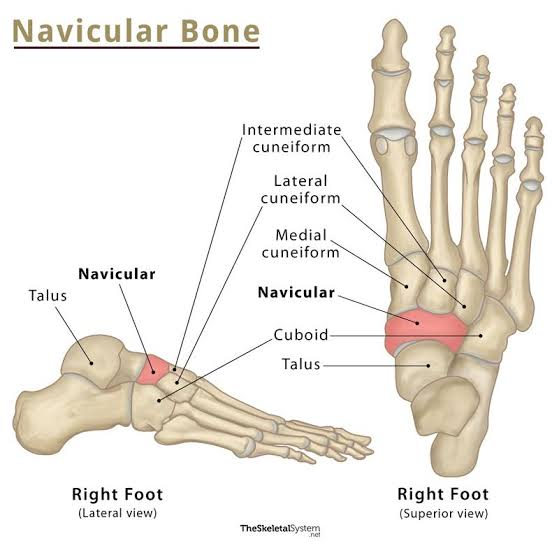 <ul><li><p>keystone bone</p></li><li><p>supports medial longitudinal arch</p></li><li><p>navicular tuberosity</p><ul><li><p>insertion site for tibialis posterior</p></li></ul></li><li><p>accessory navicular</p><ul><li><p>detached navicular tuberosity found in 11-14% of pop</p><ul><li><p>secondary ossification center [os tibiale externum]</p></li><li><p>within tibialis posterior tendon</p></li><li><p>prominent medial bump can cause painful tendinitis from shoewear</p></li></ul></li></ul></li></ul><p></p>