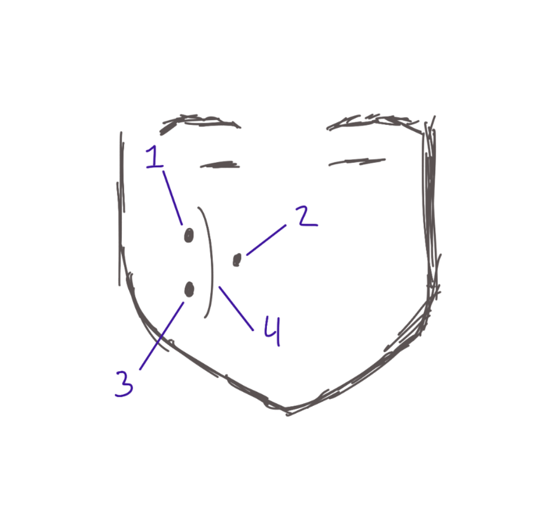 <p>Structure. Most deepest/medial pin on the cheek. #2</p>