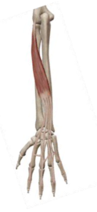 <p>what muscle and action is this </p>