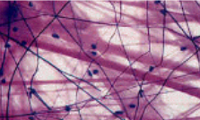 <p>areolar tissue</p>