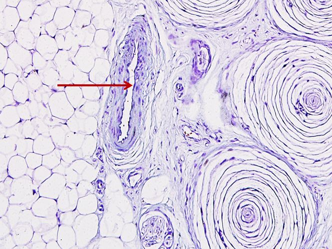 <p>Tế bào gì ?</p>