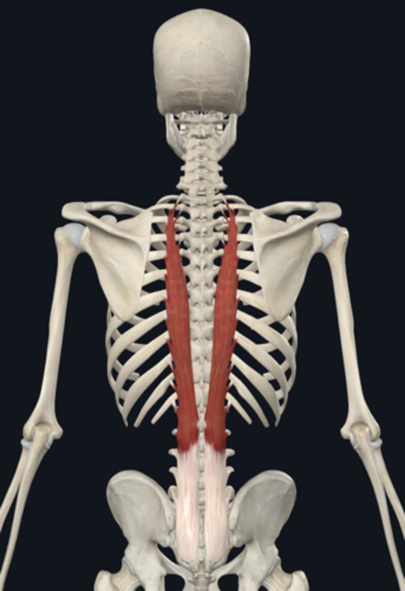 <p>Back extension</p>