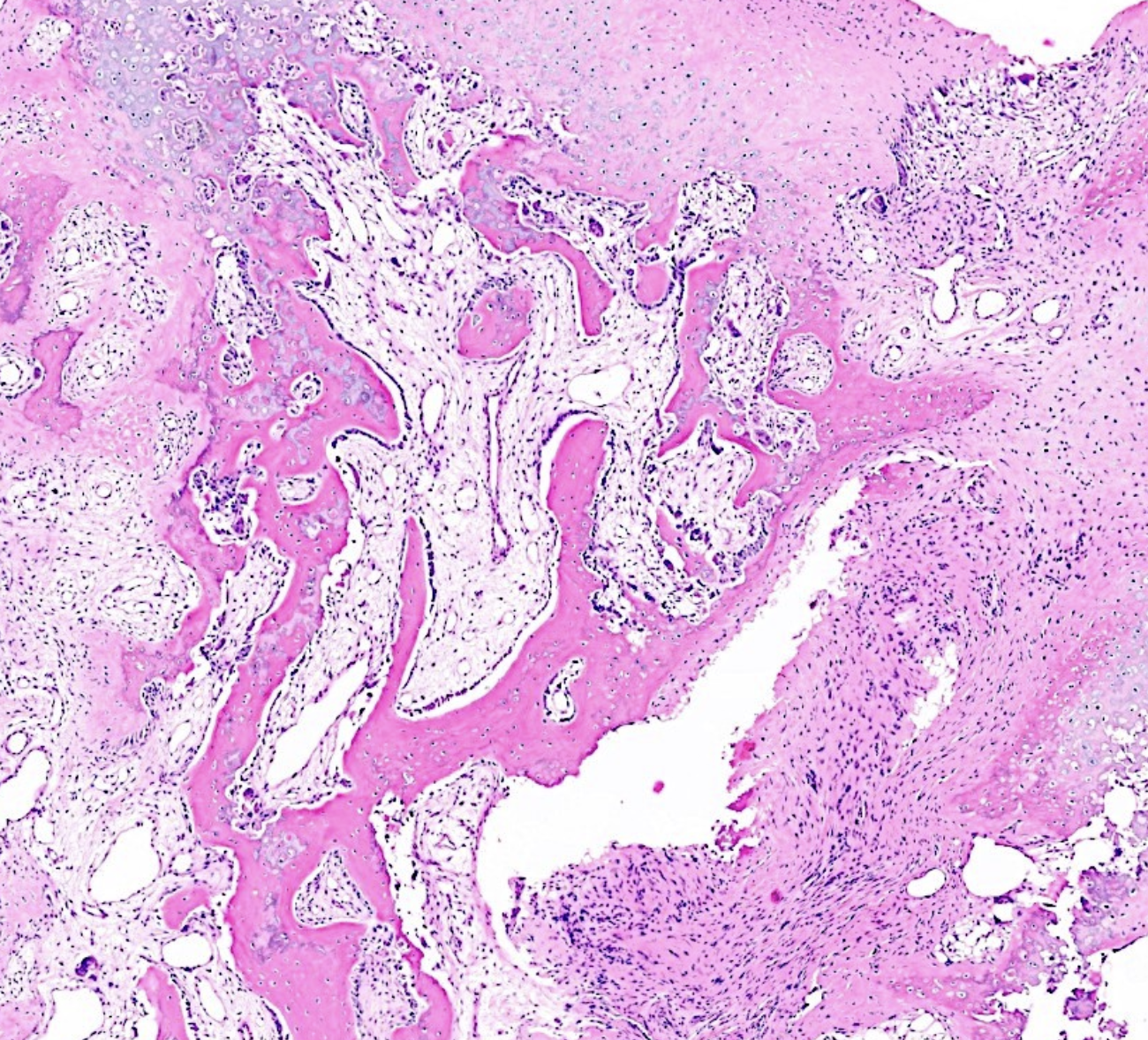 <p>Tumeur de l’os </p><p>1) diagnostic</p><p>2) localisations </p><p>3) morphologie</p><p>4) moléculaire</p><p></p>