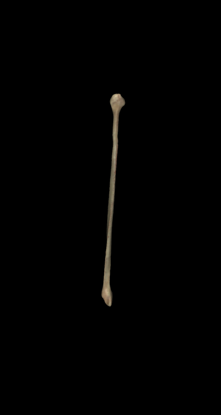 <p>left or right fibula? (posterior view)</p>
