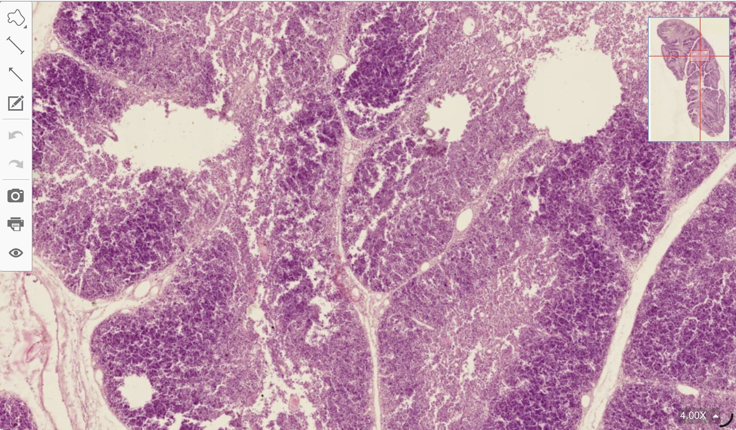 term image