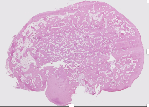 <p>Lésion ostéocondensante de la mandibule </p><p>Diagnostic</p><p>Définition</p><p>Age</p><p>Topographie</p><p>Anatomie</p><p>Histologie</p><p>Syndromes </p>