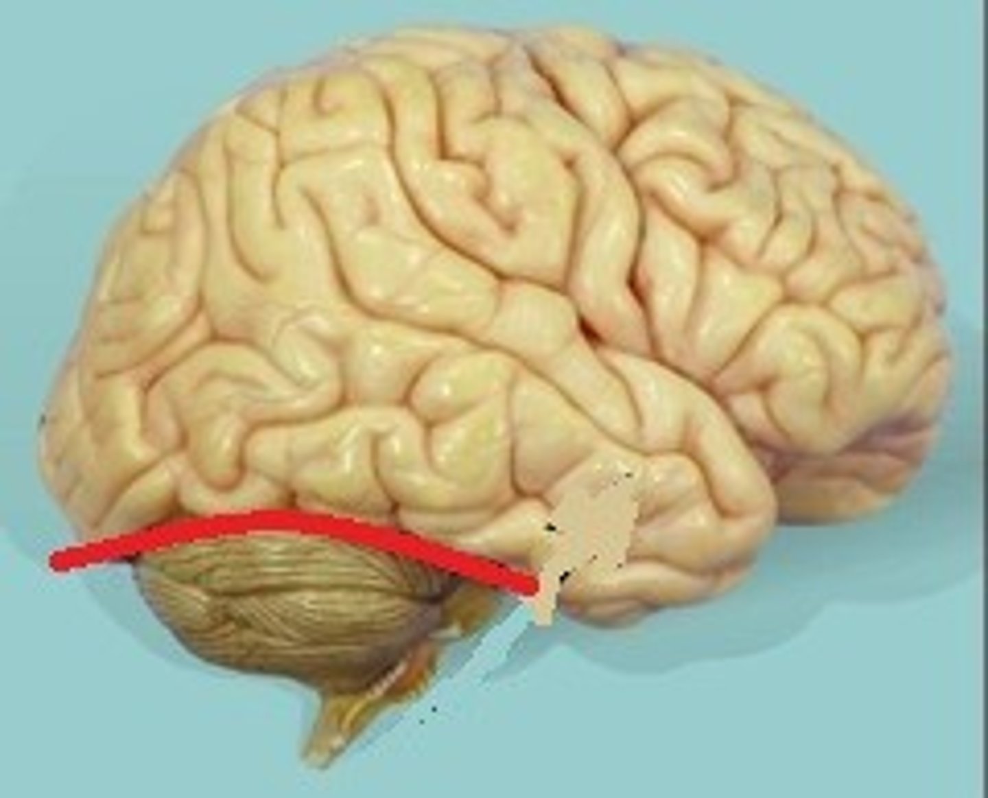 <p>Deep groove separating the cerebrum from the cerebellum in the posterior/inferior part of the brain.</p>