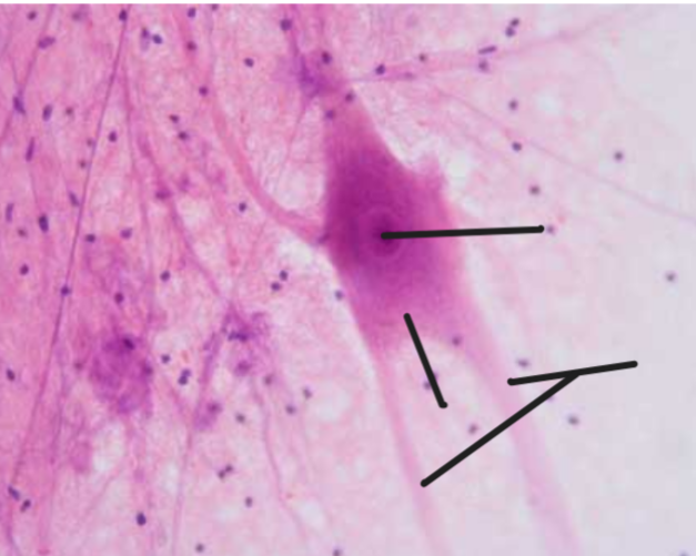 <p>What are each of the black lines pointing to? What is the overall image?</p>