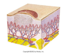 <ul><li><p>Solid</p></li><li><p>palpable lesion</p></li><li><p><10mm</p></li><li><p>elevated above skin</p></li><li><p>firm, circumscribed(well defined)</p></li></ul><p></p>