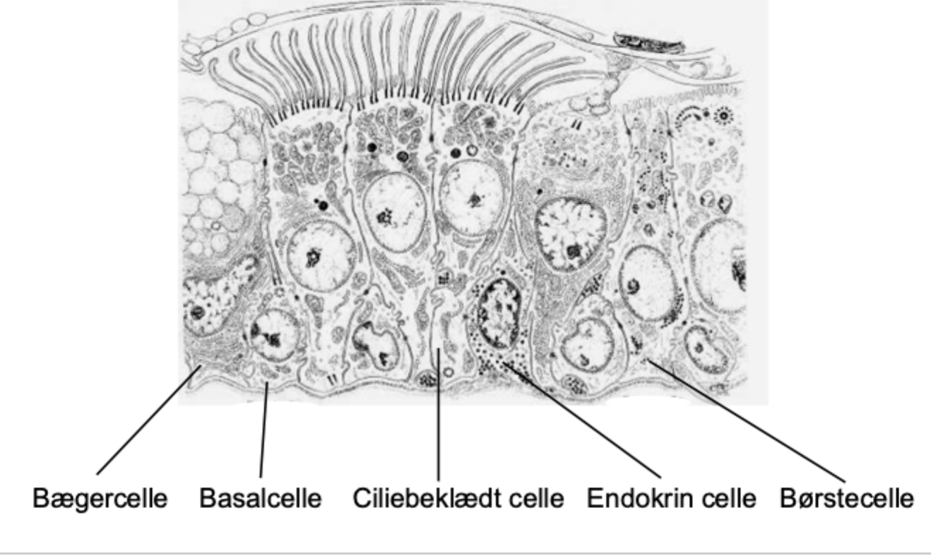<p>Rare airway epithelial cells with apical microvilli; they are generally considered sensory/chemosensory cells</p>