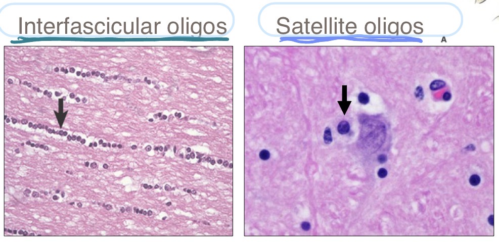 <ul><li><p>interfascicular oligodendrocytes</p><ul><li><p>found b/t axons</p></li><li><p>fxn: make myelin</p></li></ul></li><li><p>satellite oligodendrocytes</p><ul><li><p>found surrounding neuronal cell bodies</p></li><li><p>fxn: regulate perineural microenvironment</p></li></ul></li></ul><p></p>