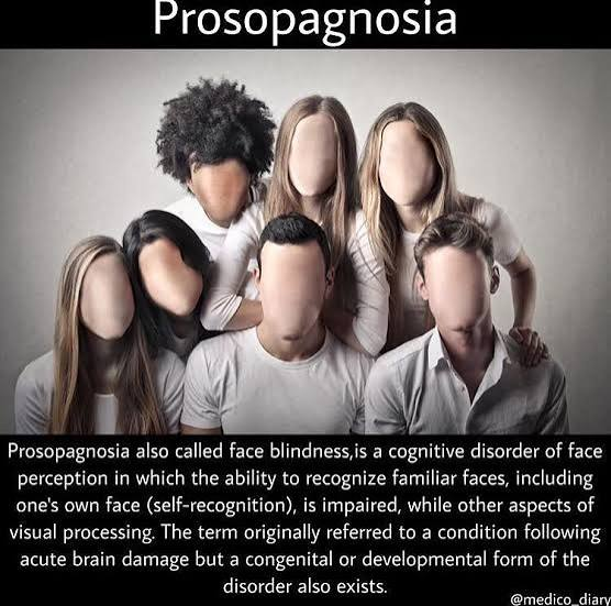 <p>An <strong>inability to recognise a familiar face</strong>, including their own when seen in a mirror or photograph</p>