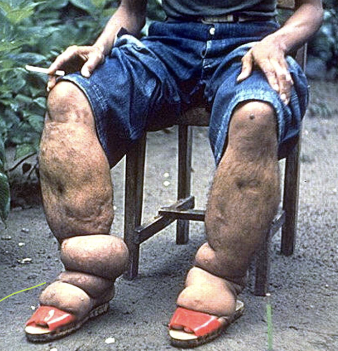 <p>What is this condition, what parasite/s cause it?</p>